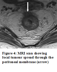 figure_4